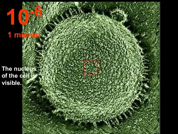 The nucleus of the cell is visible. 10-6 1 micrón