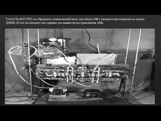 Forest Dodrill 1952 год. Применил механический насос для обхода ЛЖ