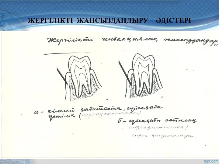 ЖЕРГІЛІКТІ ЖАНСЫЗДАНДЫРУ ӘДІСТЕРІ