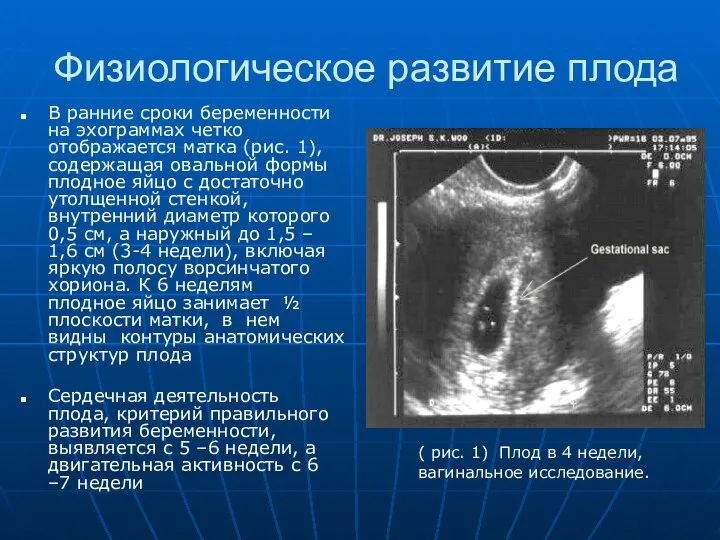 Физиологическое развитие плода В ранние сроки беременности на эхограммах четко