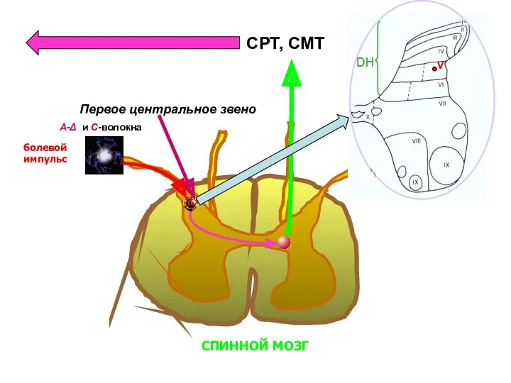 СПИННОЙ МОЗГ болевой импульс Первое центральное звено V А-Δ и С-волокна СРТ, СМТ