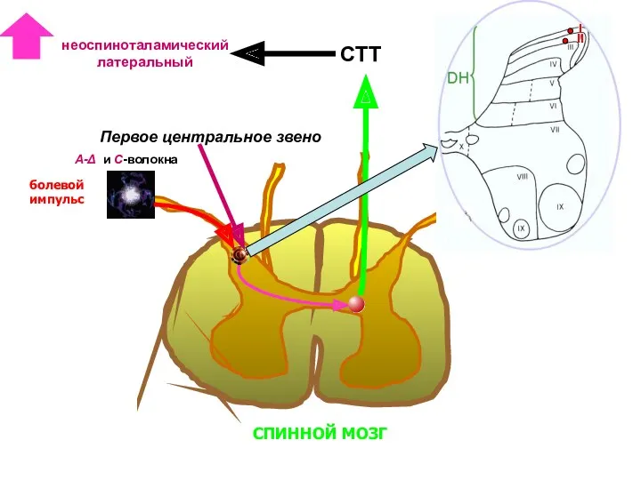 СПИННОЙ МОЗГ болевой импульс Первое центральное звено I А-Δ и С-волокна СТТ неоспиноталамический латеральный II