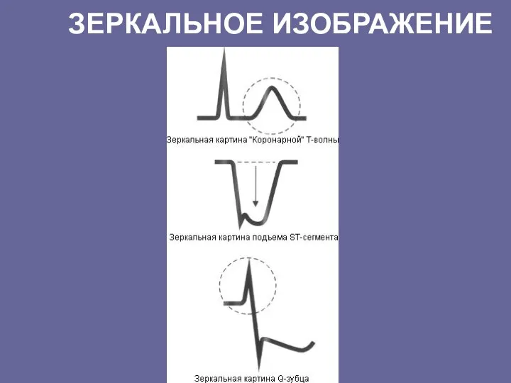 ЗЕРКАЛЬНОЕ ИЗОБРАЖЕНИЕ