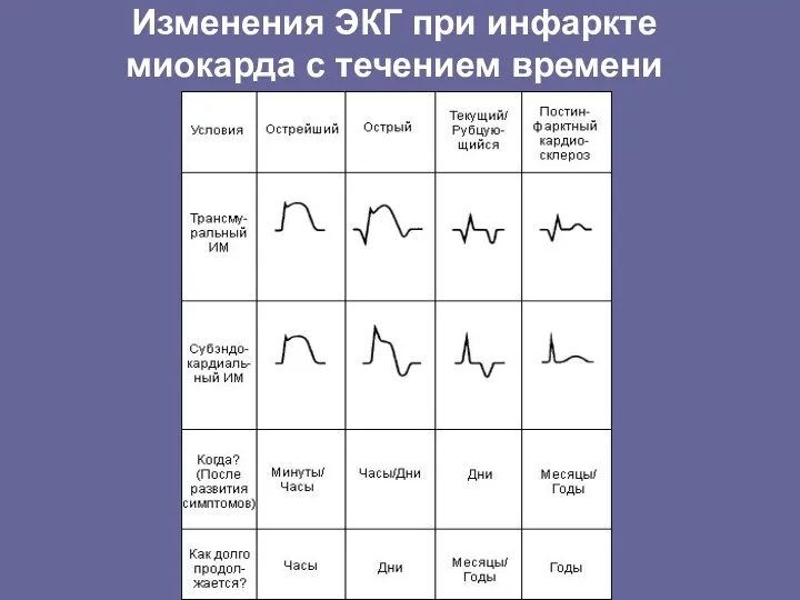 Изменения ЭКГ при инфаркте миокарда с течением времени