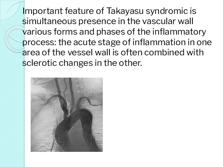 Important feature of Takayasu syndromic is simultaneous presence in the