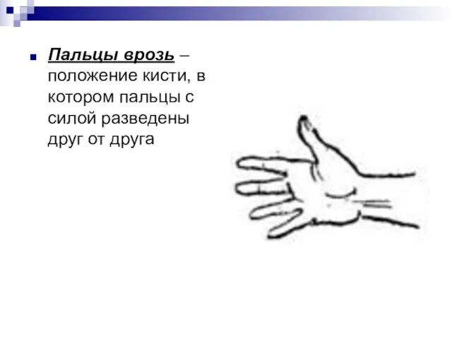Пальцы врозь – положение кисти, в котором пальцы с силой разведены друг от друга