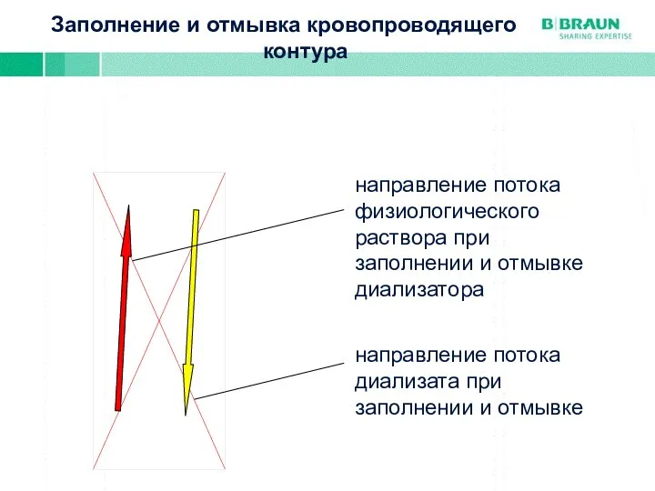 Заполнение и отмывка кровопроводящего контура направление потока физиологического раствора при