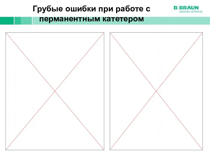 Грубые ошибки при работе с перманентным катетером