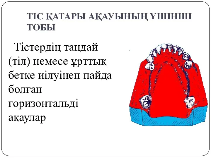 ТІС ҚАТАРЫ АҚАУЫНЫҢ ҮШІНШІ ТОБЫ Тістердің таңдай(тіл) немесе ұрттық бетке иілуінен пайда болған горизонтальді ақаулар