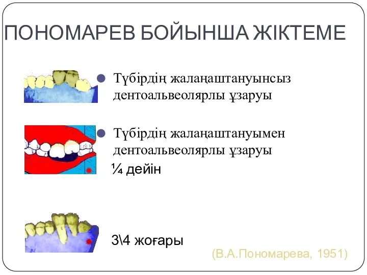 ПОНОМАРЕВ БОЙЫНША ЖІКТЕМЕ Түбірдің жалаңаштануынсыз дентоальвеолярлы ұзаруы Түбірдің жалаңаштануымен дентоальвеолярлы ұзаруы (В.А.Пономарева, 1951)