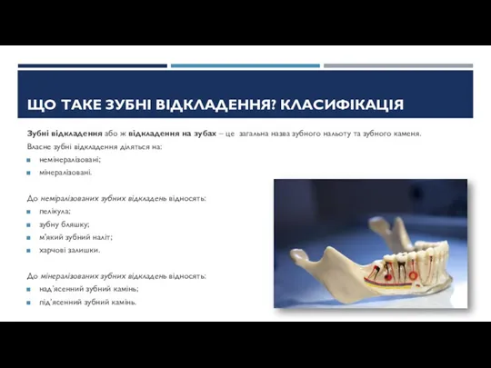 ЩО ТАКЕ ЗУБНІ ВІДКЛАДЕННЯ? КЛАСИФІКАЦІЯ Зубні відкладення або ж відкладення