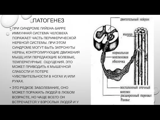 ПАТОГЕНЕЗ ПРИ СИНДРОМЕ ГИЙЕНА-БАРРЕ ИММУННАЯ СИСТЕМА ЧЕЛОВЕКА ПОРАЖАЕТ ЧАСТЬ ПЕРИФЕРИЧЕСКОЙ