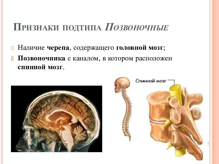 Признаки подтипа Позвоночные Наличие черепа, содержащего головной мозг; Позвоночника с каналом, в котором расположен спинной мозг.