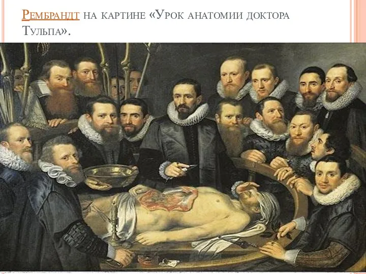Рембрандт на картине «Урок анатомии доктора Тульпа».