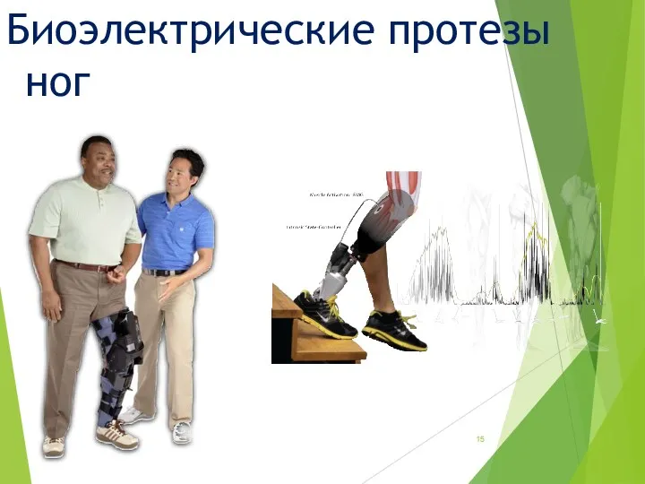 Биоэлектрические протезы ног