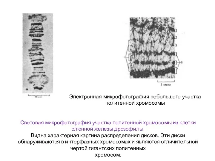 Световая микрофотография участка политенной хромосомы из клетки слюнной железы дрозофилы.