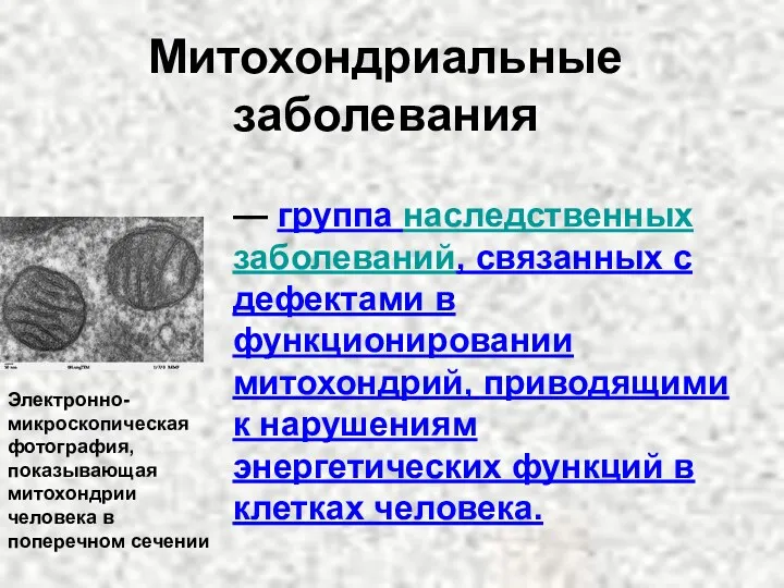 — группа наследственных заболеваний, связанных с дефектами в функционировании митохондрий,