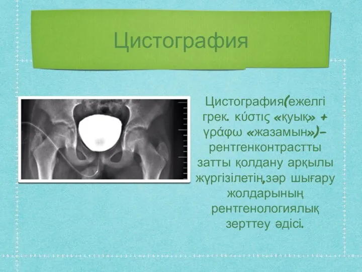 Цистография Цистография(ежелгі грек. κύστις «қуық» + γράφω «жазамын»)-рентгенконтрастты затты қолдану