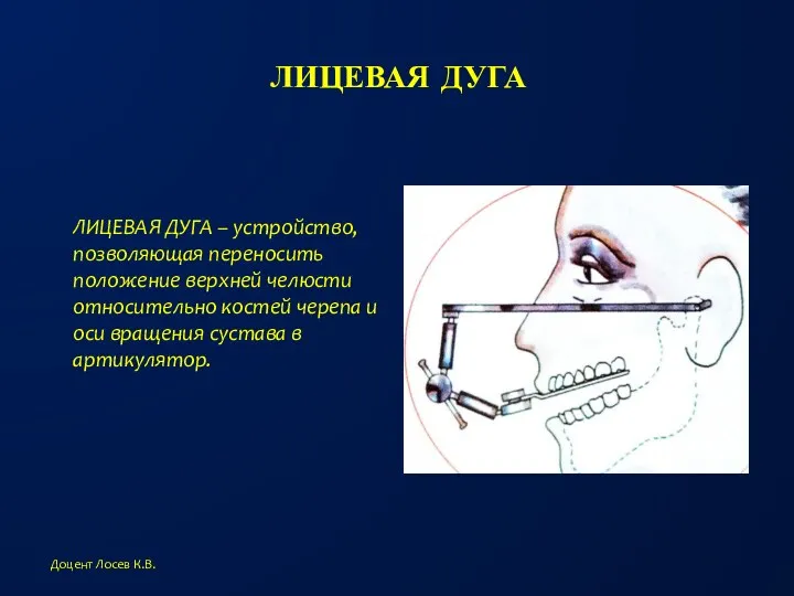 ЛИЦЕВАЯ ДУГА Доцент Лосев К.В. ЛИЦЕВАЯ ДУГА – устройство, позволяющая