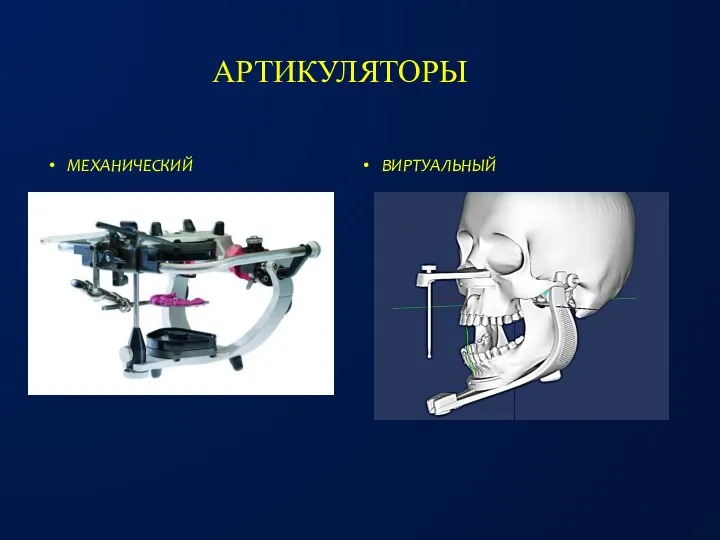 АРТИКУЛЯТОРЫ ВИРТУАЛЬНЫЙ МЕХАНИЧЕСКИЙ