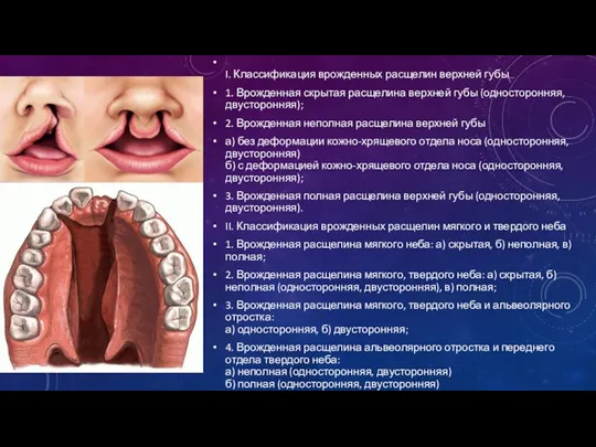 I. Классификация врожденных расщелин верхней губы 1. Врожденная скрытая расщелина верхней губы (односторонняя,