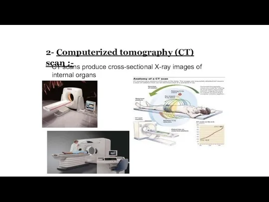 2- Computerized tomography (CT) scan :- CT scans produce cross-sectional X-ray images of