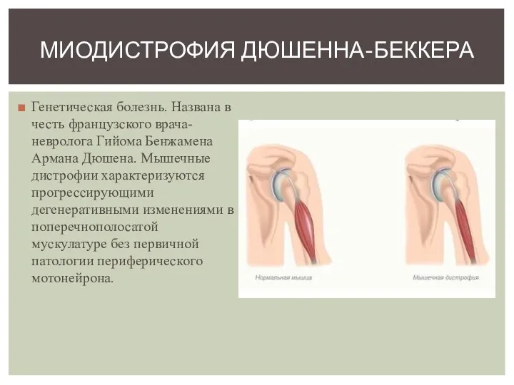 Генетическая болезнь. Названа в честь французского врача-невролога Гийома Бенжамена Армана