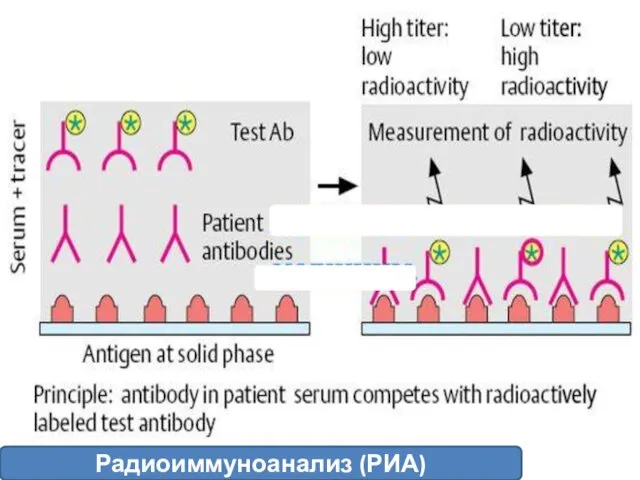 Радиоиммуноанализ (РИА)