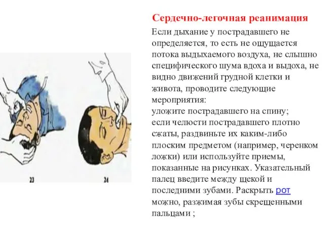 Сердечно-легочная реанимация Если дыхание у пострадавшего не определяется, то есть