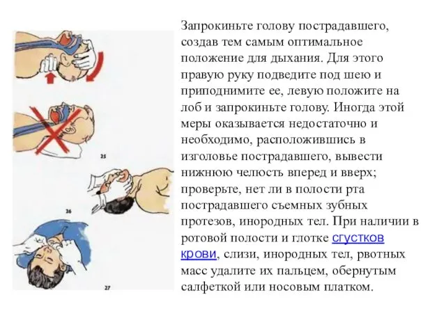 Запрокиньте голову пострадавшего, создав тем самым оптимальное положение для дыхания.