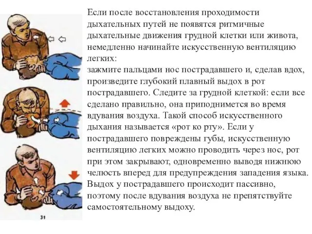 Если после восстановления проходимости дыхательных путей не появятся ритмичные дыхательные