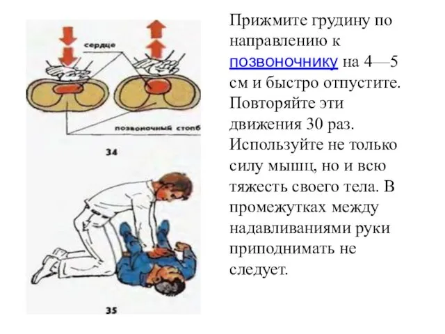 Прижмите грудину по направлению к позвоночнику на 4—5 см и