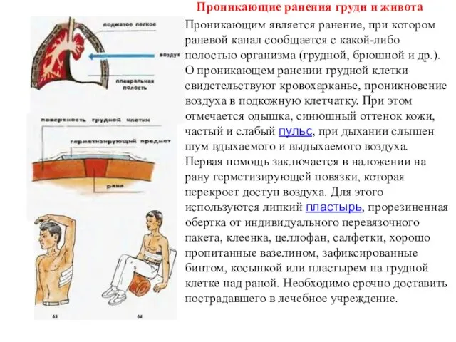 Проникающие ранения груди и живота Проникающим является ранение, при котором