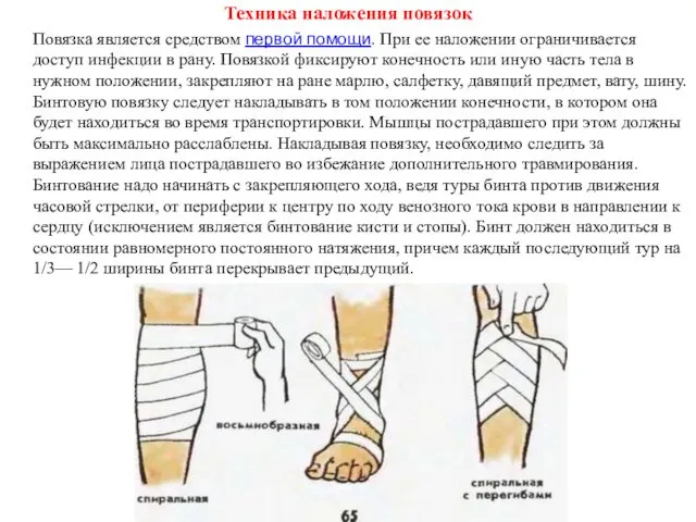 Техника наложения повязок Повязка является средством первой помощи. При ее