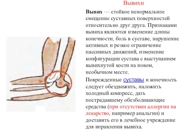 Вывихи Вывих — стойкое ненормальное смещение суставных поверхностей относительно друг