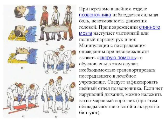 При переломе в шейном отделе позвоночника наблюдается сильная боль, невозможность