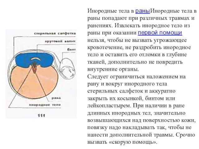 Инородные тела в раныИнородные тела в раны попадают при различных