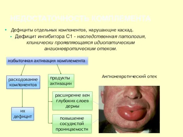 НЕДОСТАТОЧНОСТЬ КОМПЛЕМЕНТА Дефицит ингибитора С1 - наследственная патология, клинически проявляющаяся