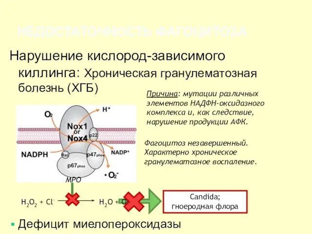 НЕДОСТАТОЧНОСТЬ ФАГОЦИТОЗА Нарушение кислород-зависимого киллинга: Хроническая гранулематозная болезнь (ХГБ) Дефицит