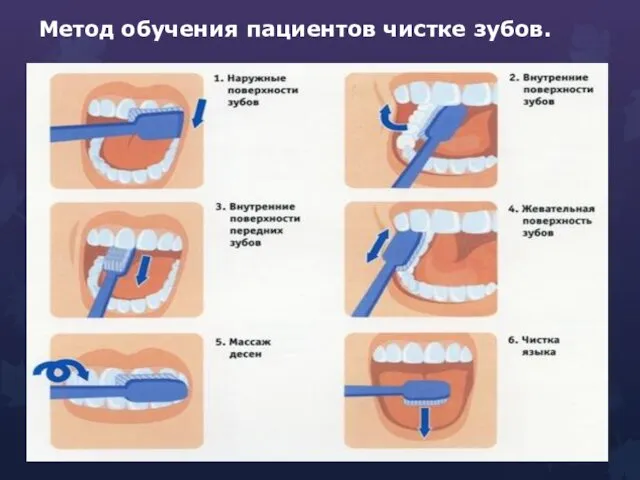 Метод обучения пациентов чистке зубов.