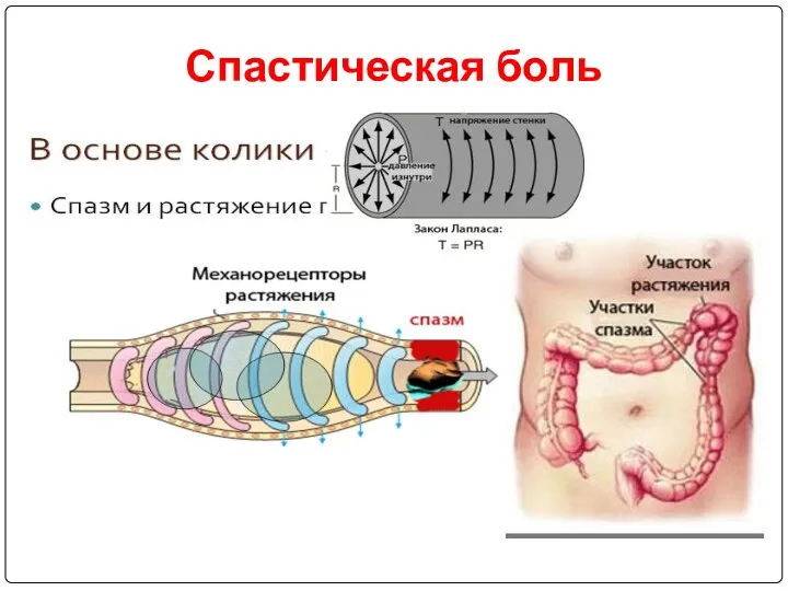 Спастическая боль