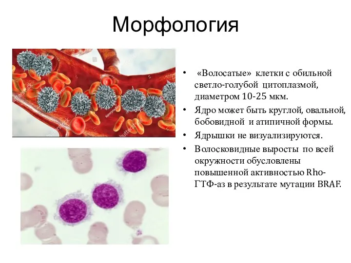 Морфология «Волосатые» клетки с обильной светло-голубой цитоплазмой, диаметром 10-25 мкм.