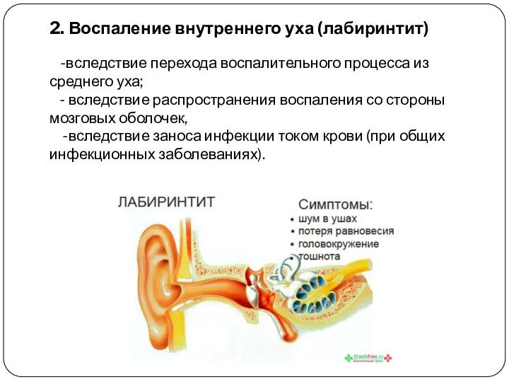 2. Воспаление внутреннего уха (лабиринтит) -вследствие перехода воспалительного процесса из