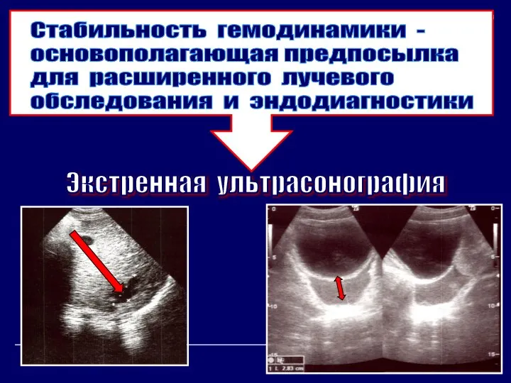 Стабильность гемодинамики - основополагающая предпосылка для расширенного лучевого обследования и эндодиагностики Экстренная ультрасонография