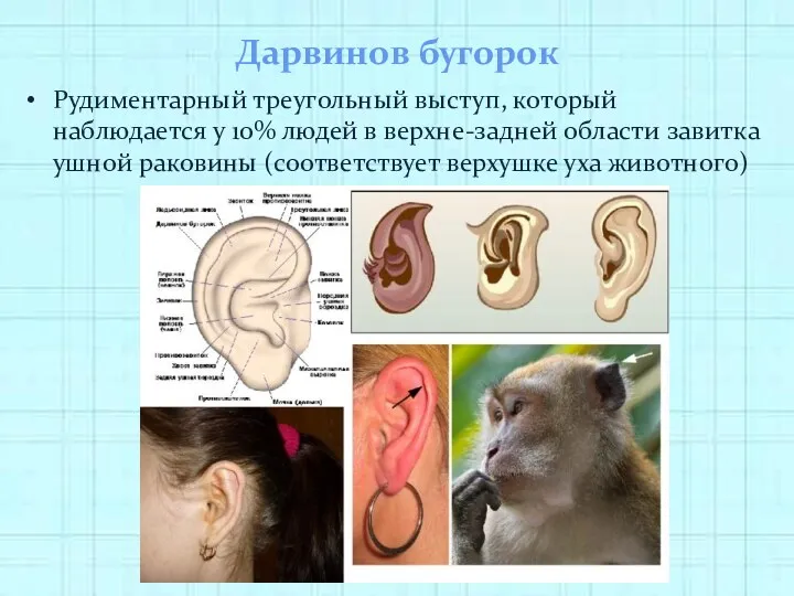 Дарвинов бугорок Рудиментарный треугольный выступ, который наблюдается у 10% людей