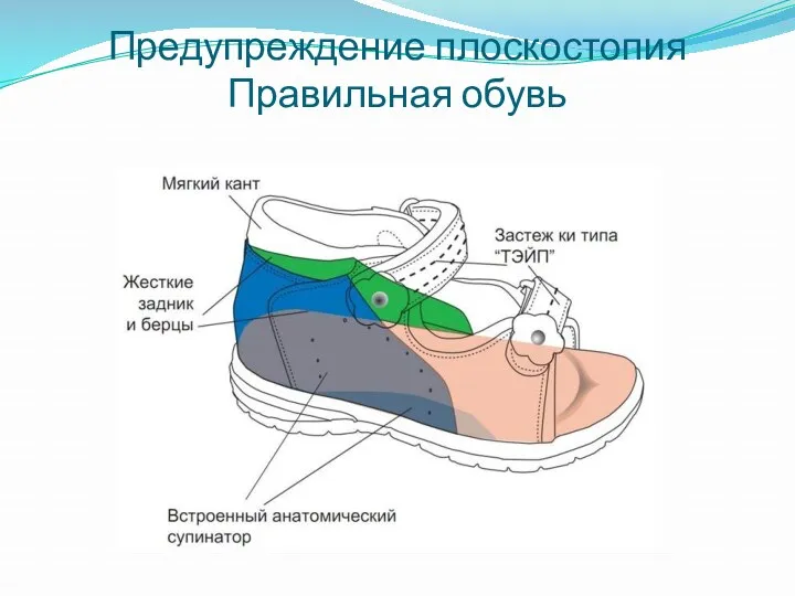Предупреждение плоскостопия Правильная обувь