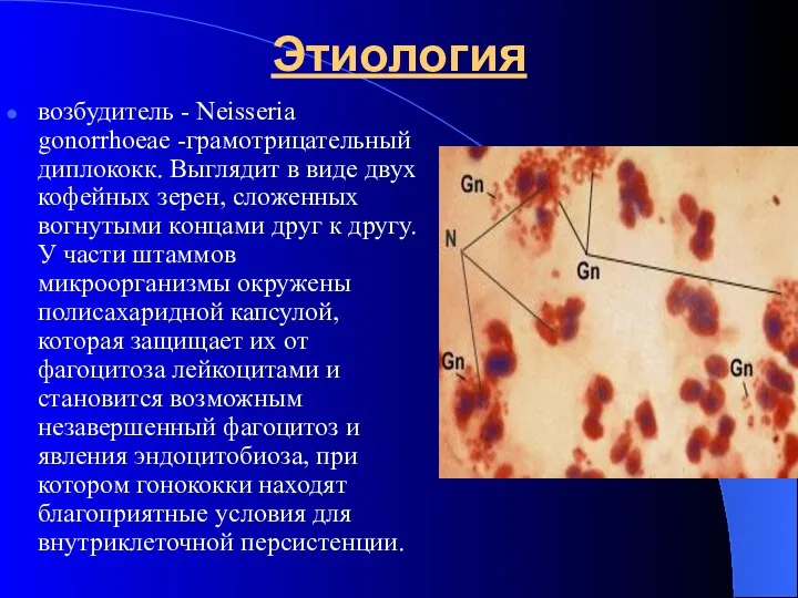 Этиология возбудитель - Neisseria gonorrhoeae -грамотрицательный диплококк. Выглядит в виде