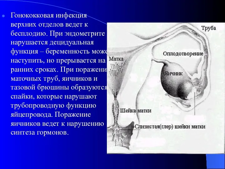 Гонококковая инфекция верхних отделов ведет к бесплодию. При эндометрите нарушается