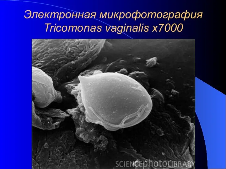 Электронная микрофотография Tricomonas vaginalis х7000