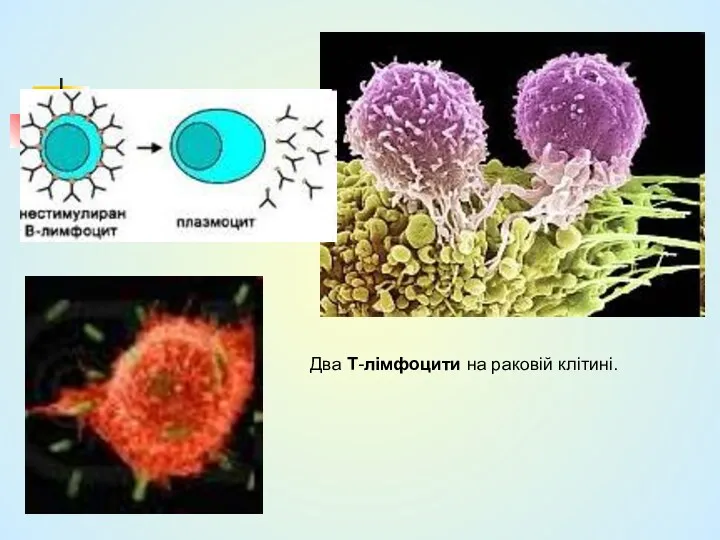 Два Т-лімфоцити на раковій клітині.
